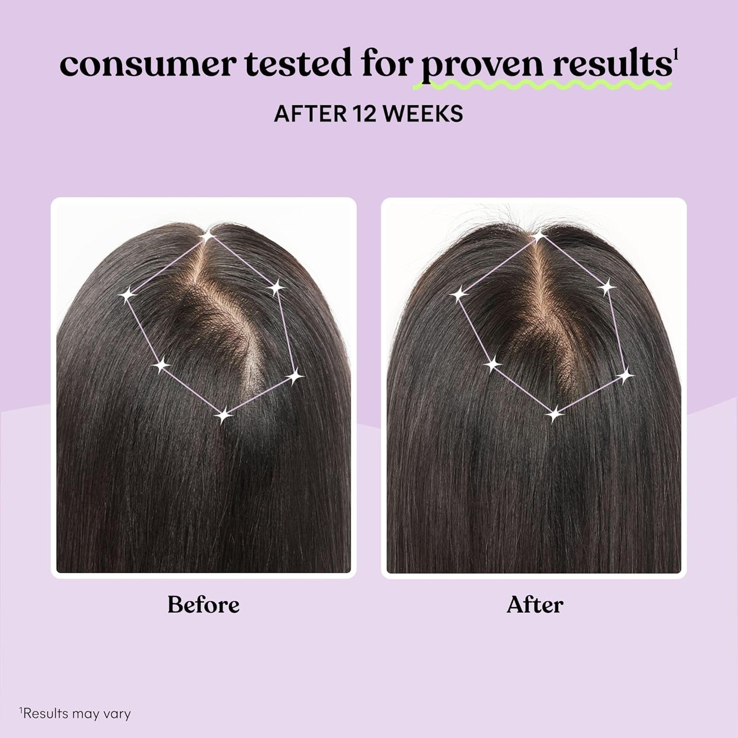 Grow Hair Growth Supplement for Women, Clinically Proven Keratin Complex for Visibly Thicker Hair and Scalp Coverage, Reduced Shedding, Nourish Thinning Hair - 1 Month Supply