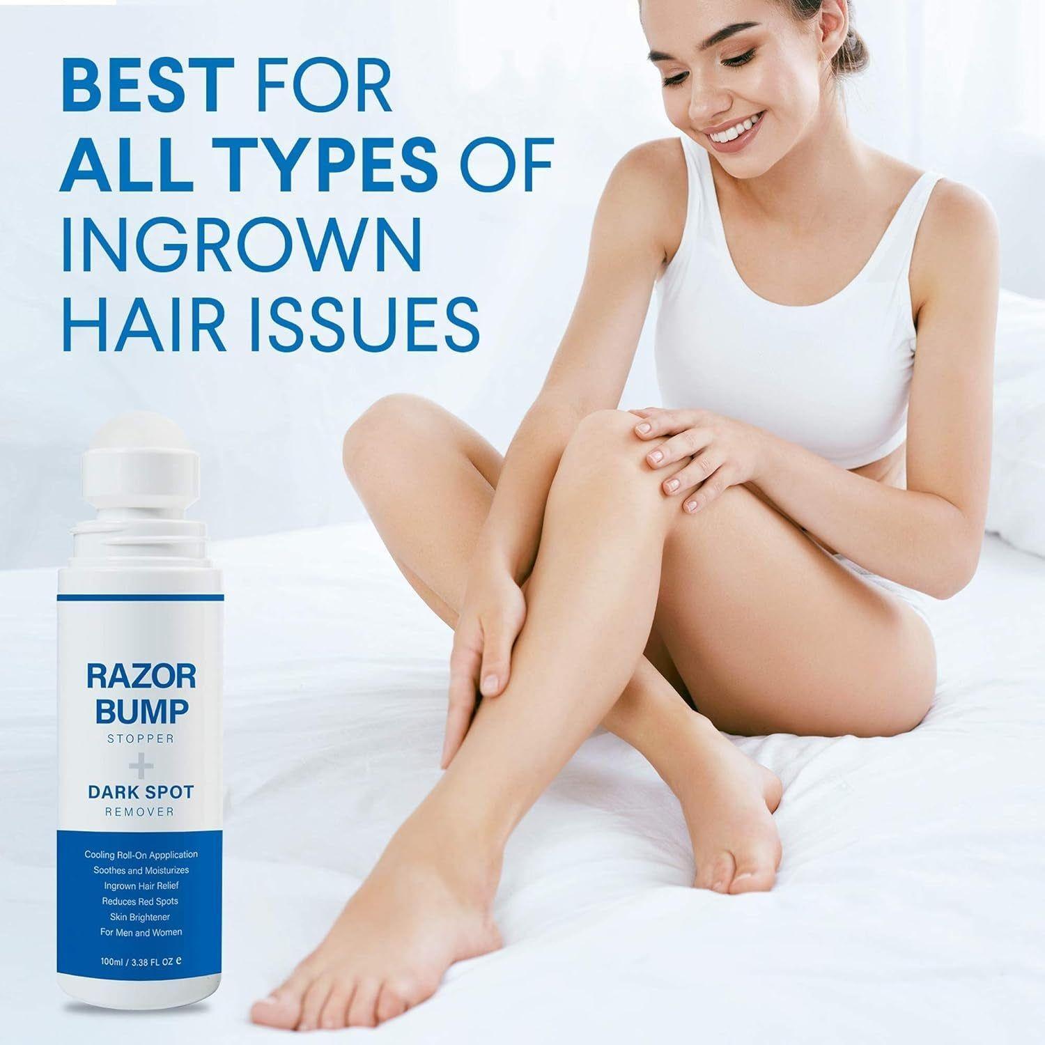 Sielkin Razor Bump Stopper + Dark Spot Remover – 100ml | Smooth, Clear & Even-Toned Skin
