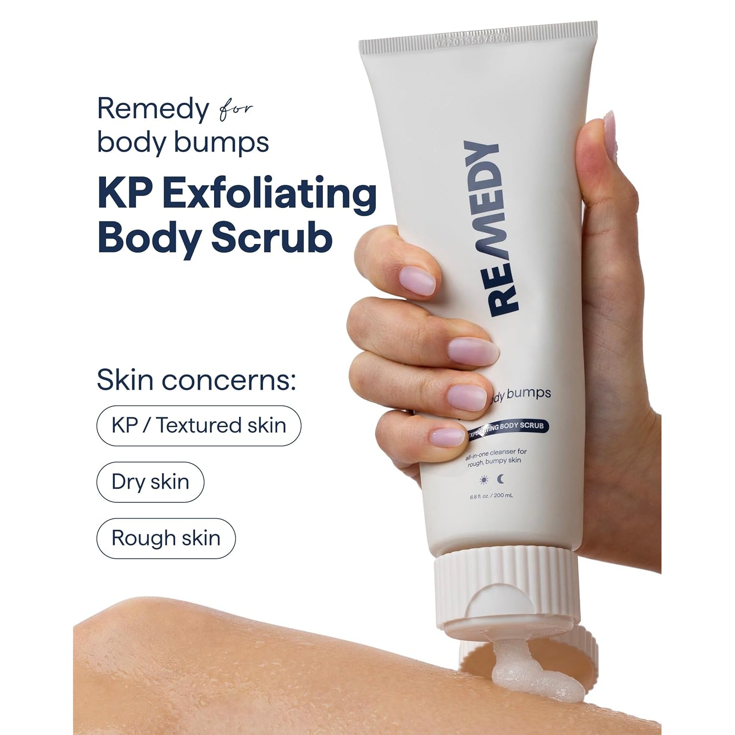 Remedy KP Exfoliating Body Scrub | Keratosis Pilaris and Chicken Skin Treatment - 200ml