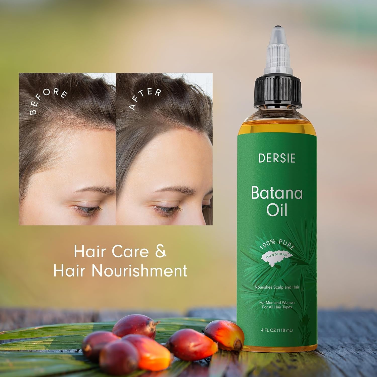 Dersie 100% Pure Batana Oil - Organic Lightweight Leave-In & Pre-Wash Oil for Dry, Damaged, High Porosity Hair - Scalp & Hair Care for Healthier, Longer-Looking Hair - Honduras Sourced (4 Fl Oz)