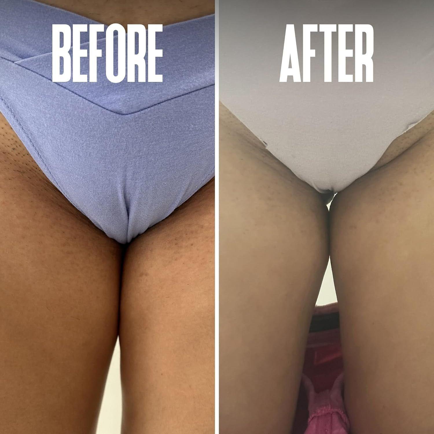 Divine Derriere Ingrown Hair Pads – 50 Pads | Exfoliating Razor Bump & Ingrown Hair Treatment