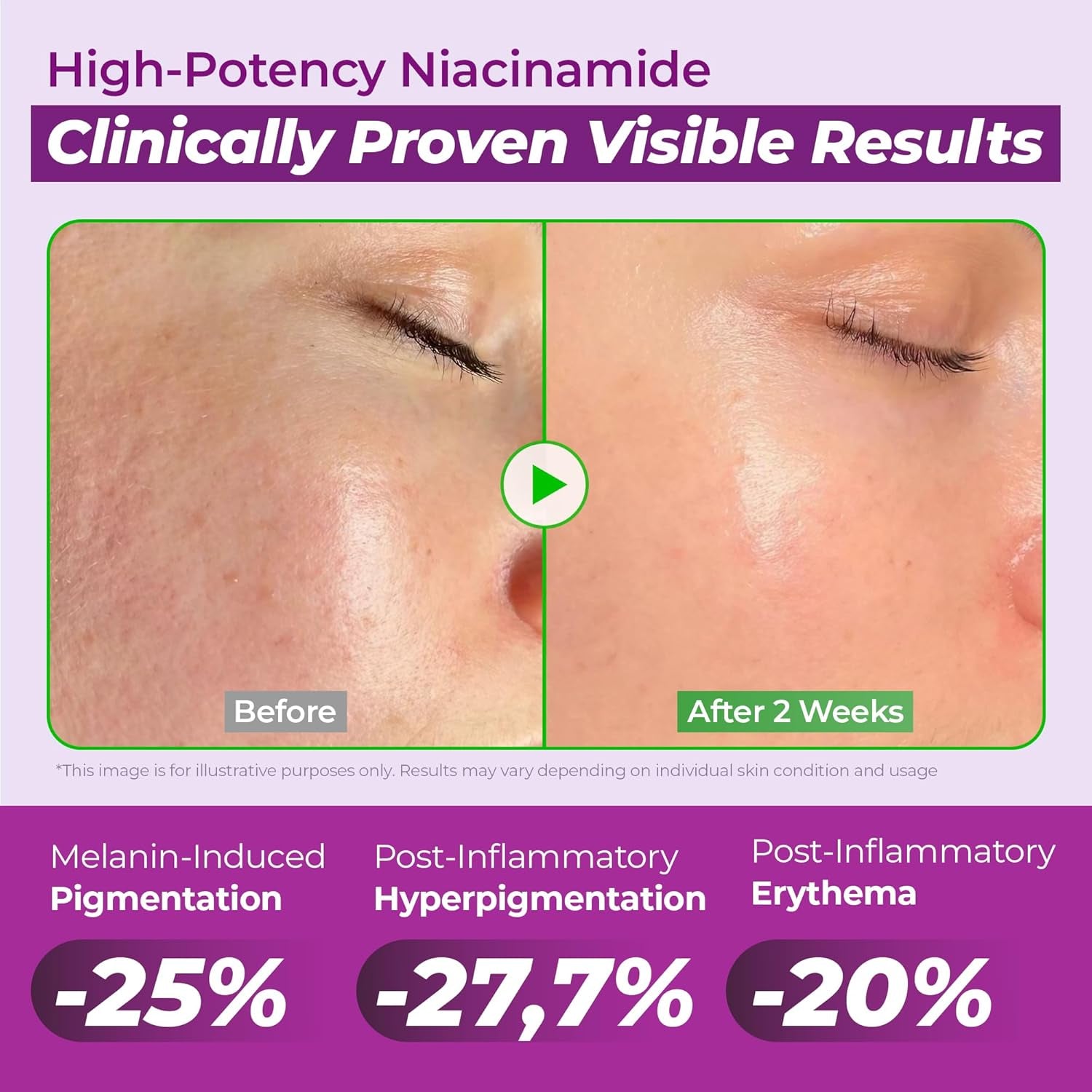 JUMISO 20% Niacinamide Dark Spot Serum – TXA Tranexamic Acid + Glutathione Face Serum – Helps Even Skin Tone, Pore Care, Glass Skin Finish – Centella Soothing, Sensitive Skin Safe, 1.35 Fl Oz