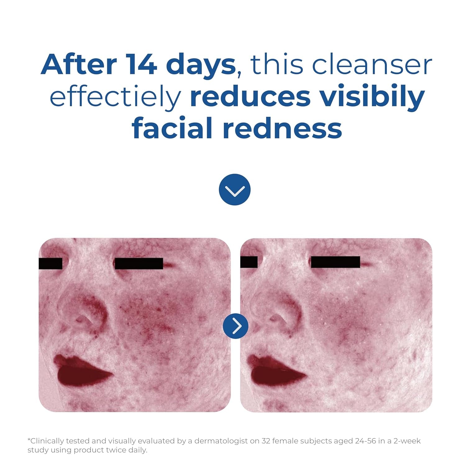 Eltamd Skin Recovery Amino Acid Foaming Facial Cleanser, Gentle Face Cleanser for Sensitive Skin and Post-Procedure Skin