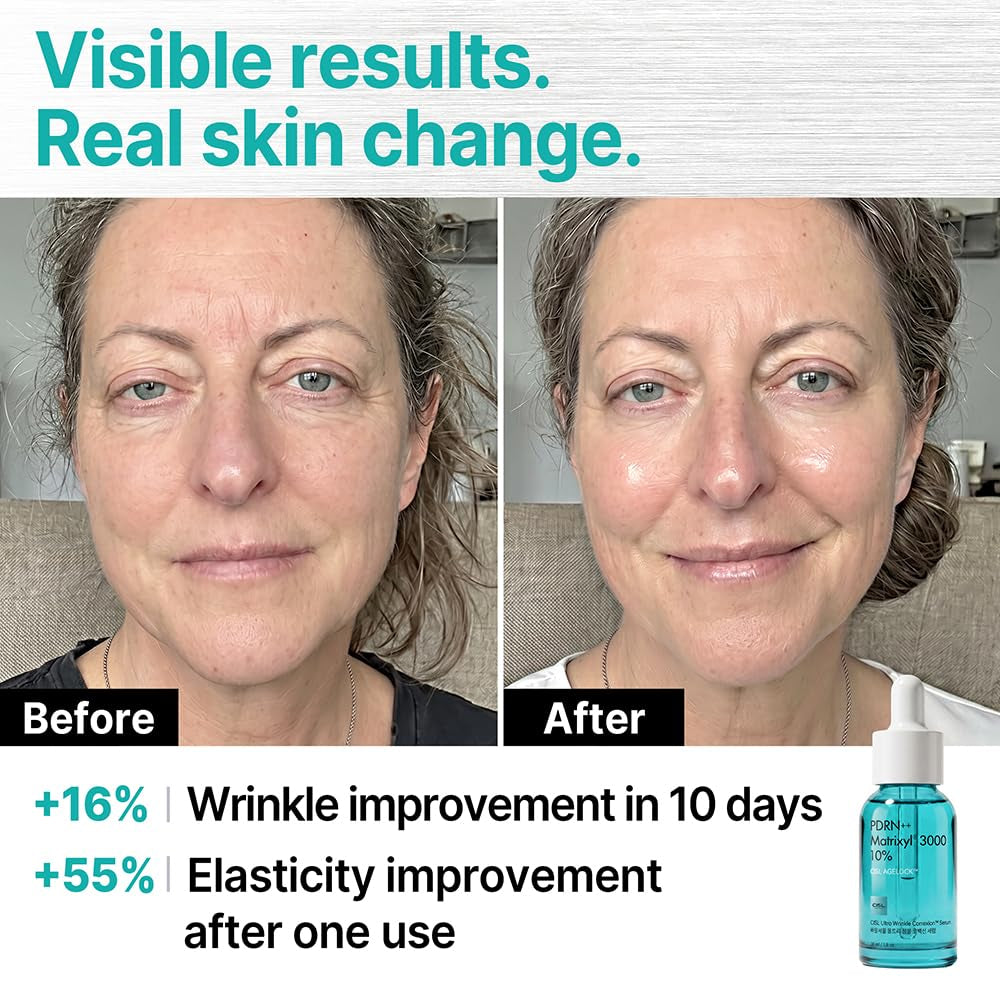 PDRN Serum with Salmon DNA — Korean Regenerative Skin Booster | DERBIOME® PDRN 5% + Matrixyl® 3000 + Exosomes for Visible Renewal, Firming & Glass Skin | Fragrance Free, 30Ml