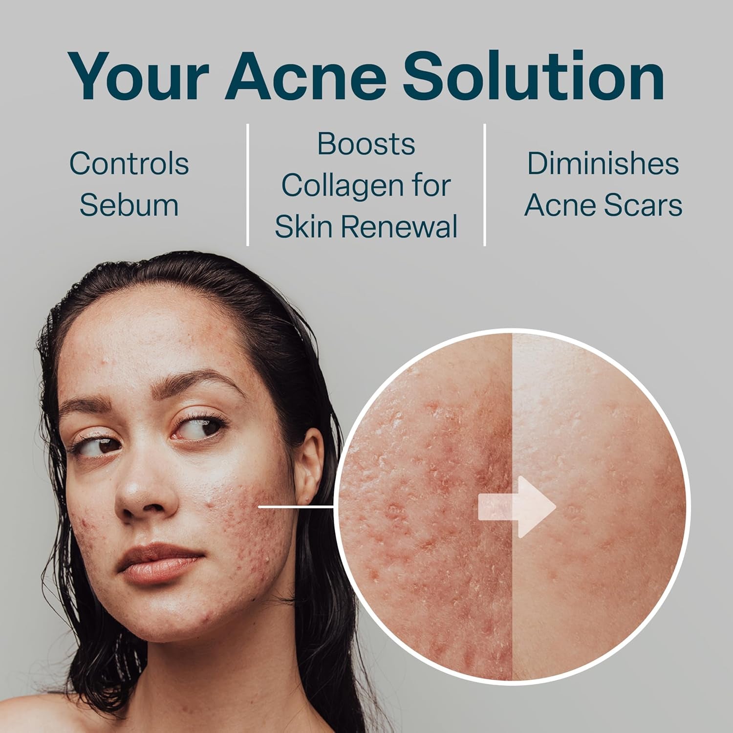 QRxLabs Salicylic and Glycolic Acid Pads – product view 4