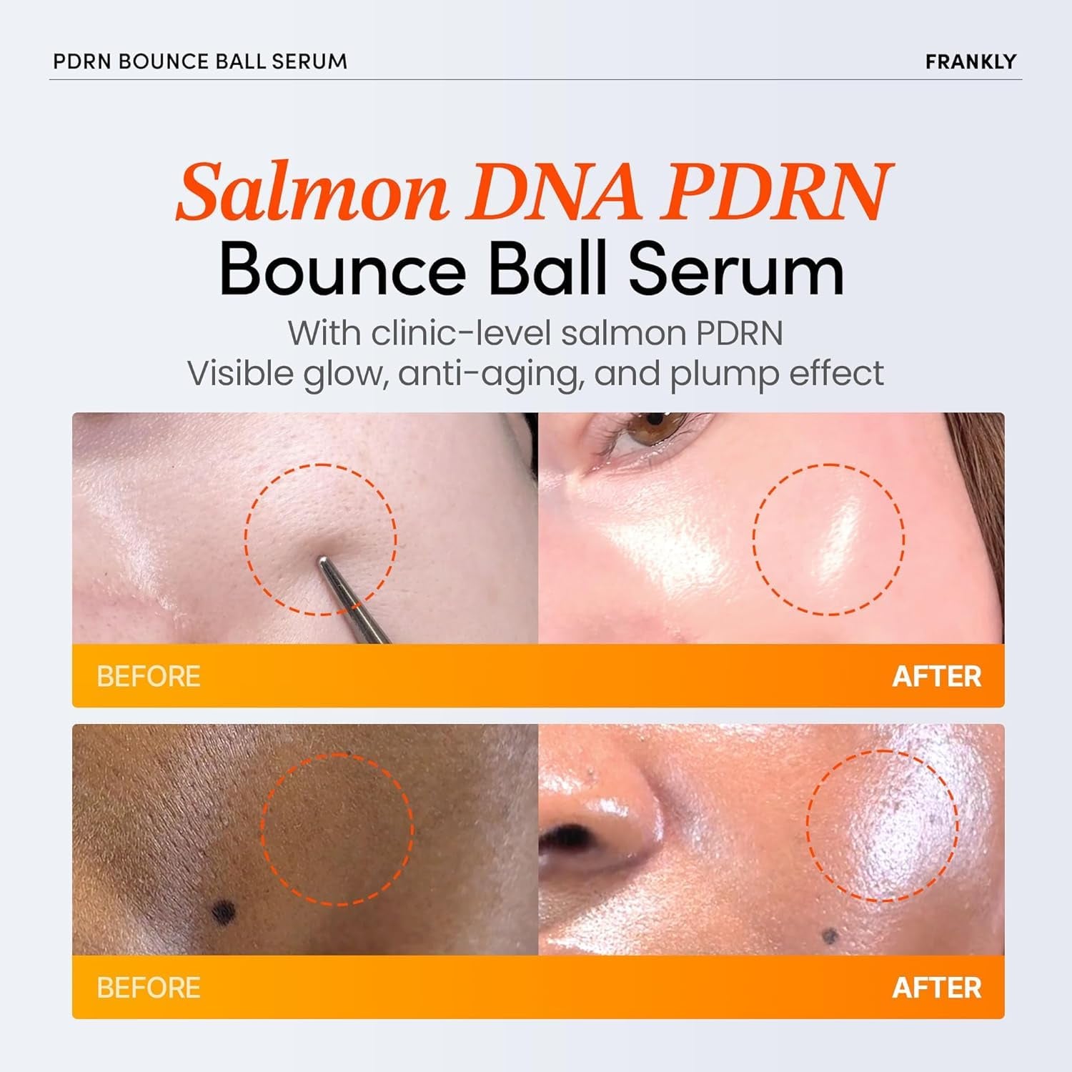 FRANKLY Salmon PDRN Bounce Ball Serum – 99% Pure Salmon DNA PDRN for Post Microneedling Recovery, Redness & Damaged Skin Repair | Glass Skin Korean Skincare | Lightweight, Non Sticky | 1.01 Fl Oz