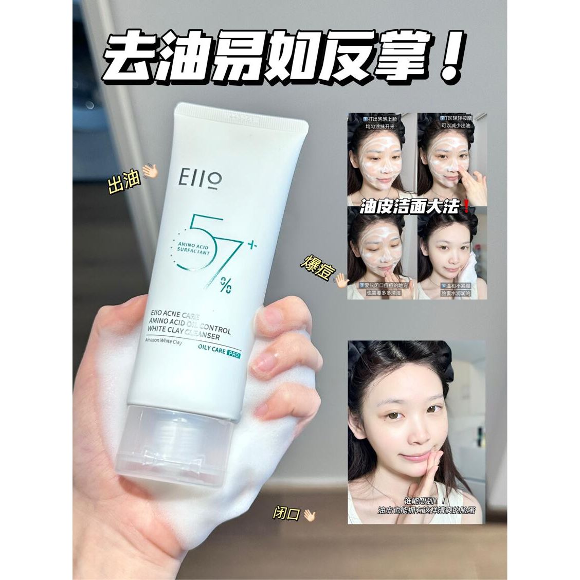 EIIO Acne Care Amino Acid Oil Control White Clay Cleanser 100g – Oil Control