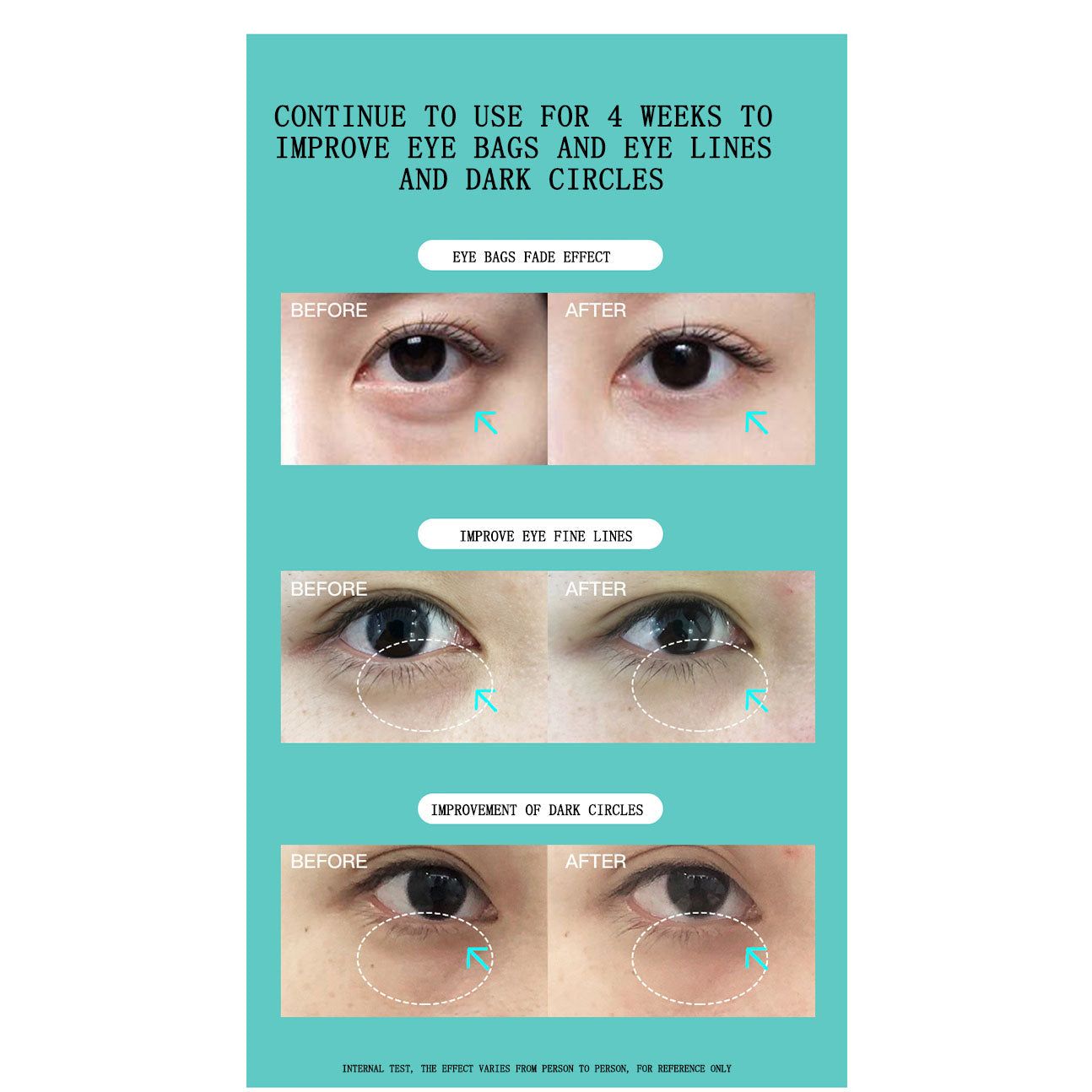 Masajeador de ojos JUJY Pro iHero