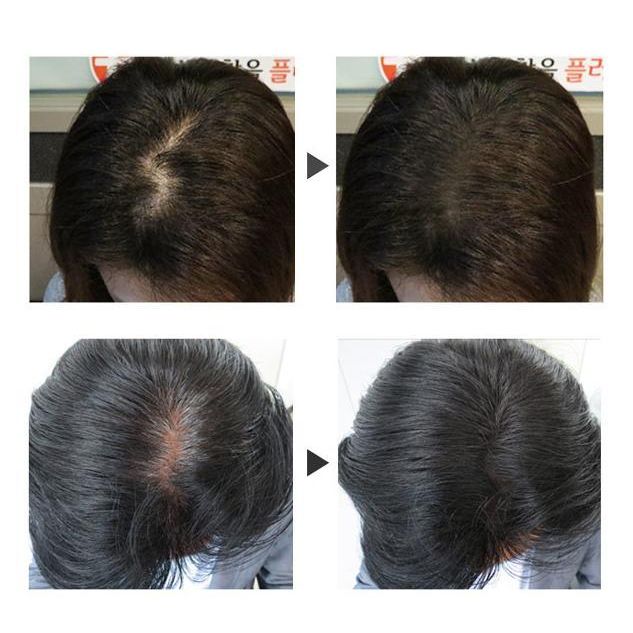 WENNIL Hair Nourishing Comb
