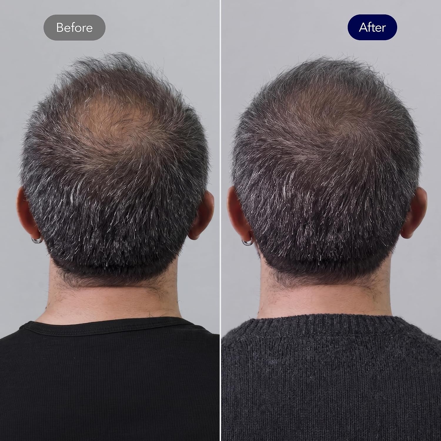 Vivelab Hair Strengthening Biotin Shampoo with Peptides - Anti-Thinning, Moisturizing & Volumizing Formula for Healthy Hair Growth, Clinically Tested Sulfate-Free Scalp Care for Men & Women
