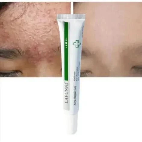 Acne Nourishing Repair Spot Gel - Glam Global UKGlam Global UK