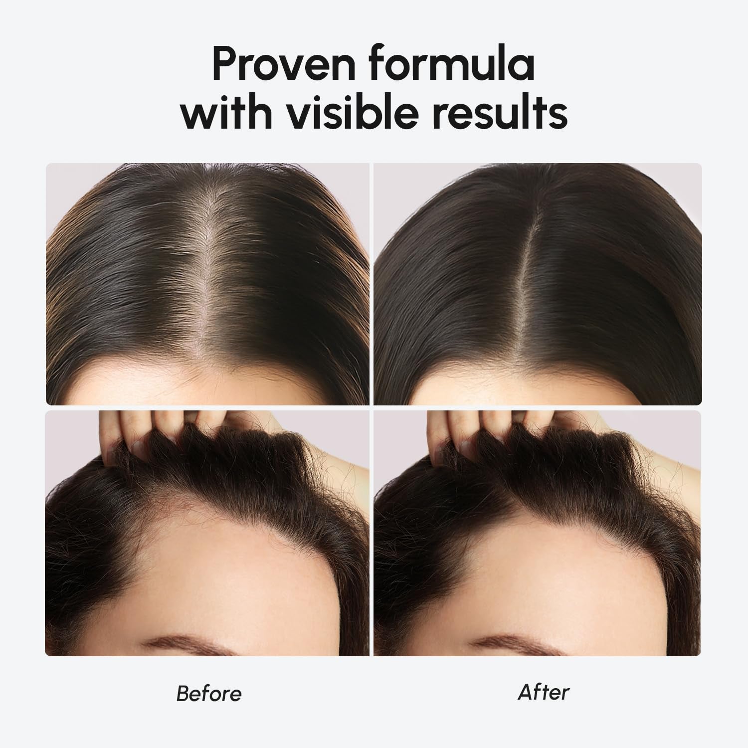 MAREE Hair Growth Serum – Caffeine, Peptides & Rosemary Oil for Thicker, Fuller Hair | 120ml
