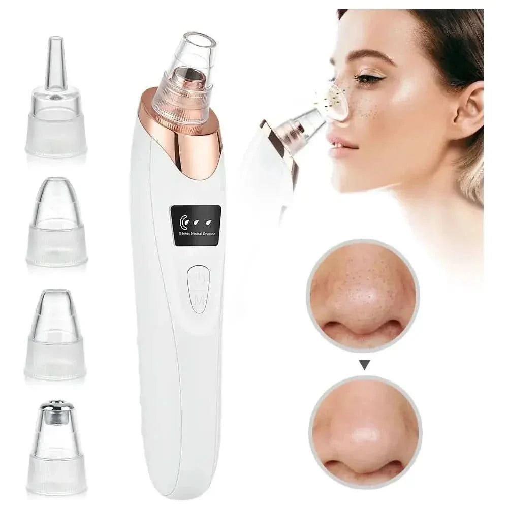 Blackhead Remover Vacuum – Acne, Pimple & Black Spot Treatment - Glam Global UKGlam Global UK