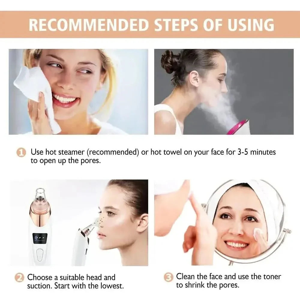 Blackhead Remover Vacuum – Acne, Pimple & Black Spot Treatment - Glam Global UKGlam Global UK
