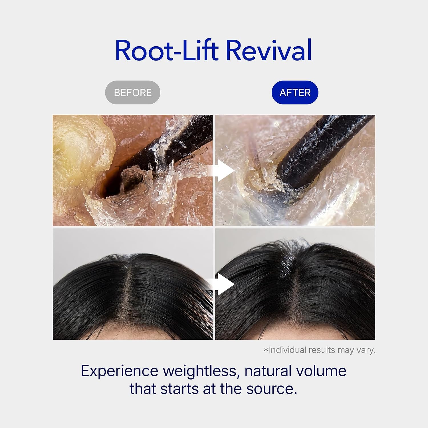 Vivelab Spioxyl 400 Microneedling Hair Growth Serum - Volumizing Scalp Treatment for Root Lifting, Scalp Care with Biotin, Caffeine & Peptides, Clinically Tested Spicule for Thicker & Stronger Hair