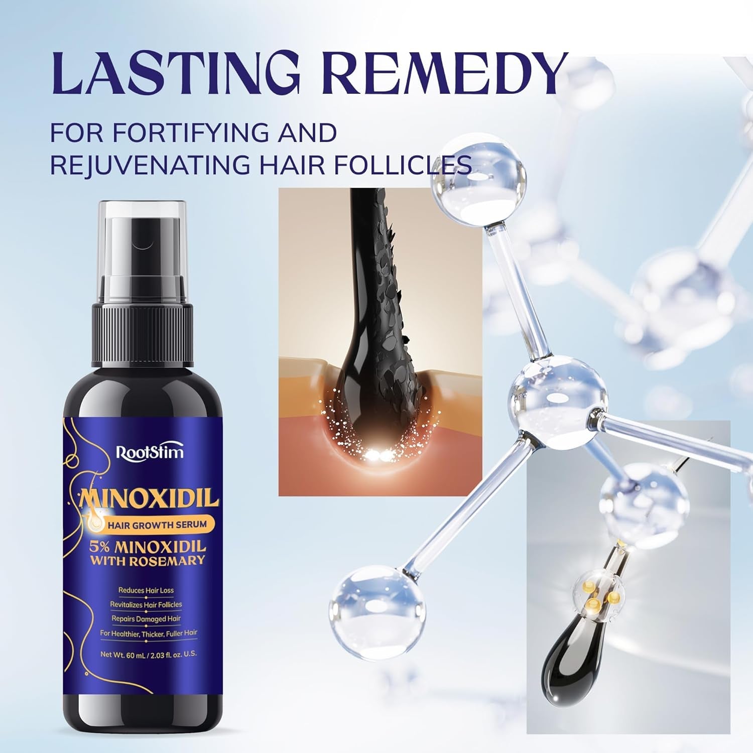 5% Minoxidil Hair Growth for Men and Women: Extra Strength Minoxidil Hair Loss Treatment Serum with Rosemary for Faster Stronger Thicker Hair Growth 60ML
