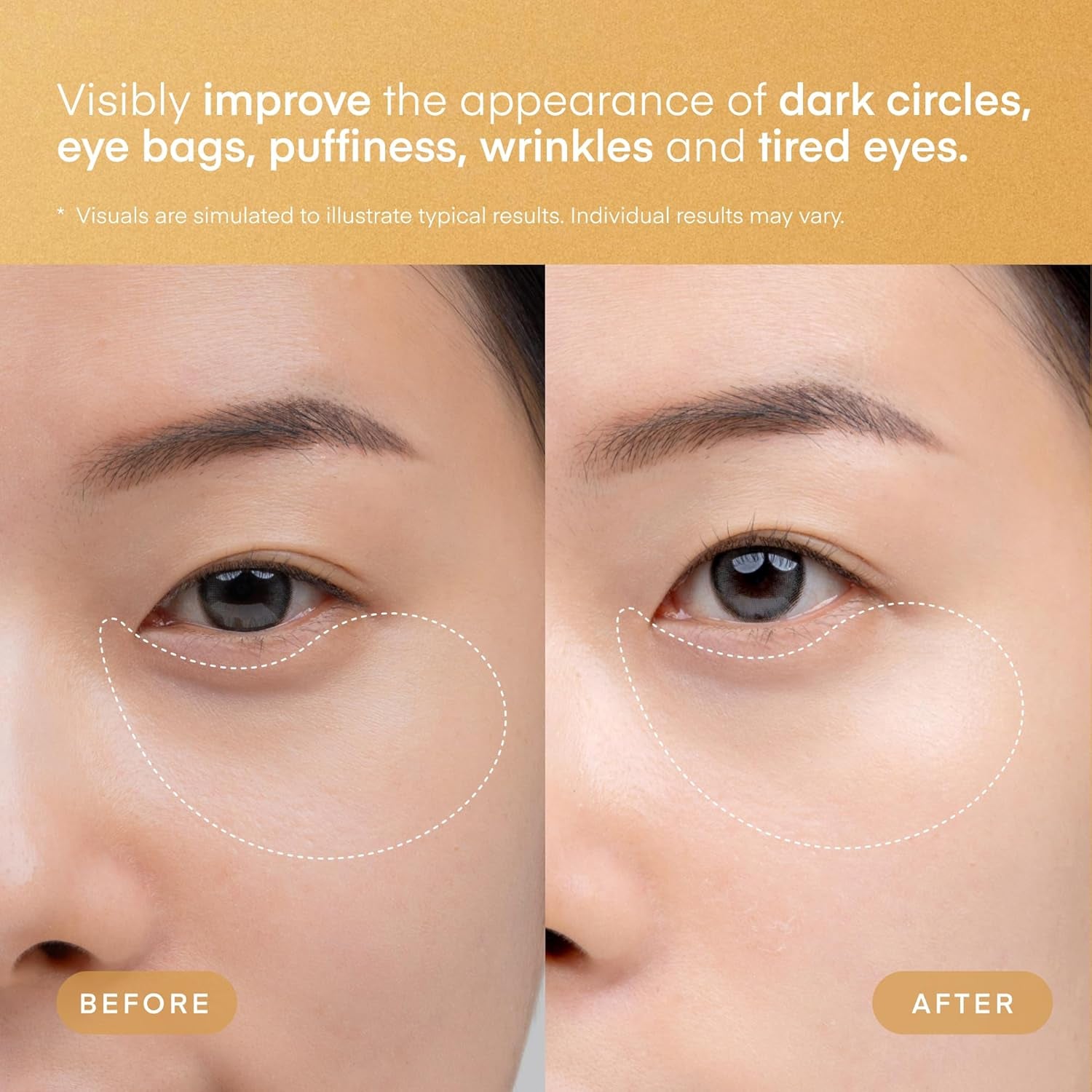 TEREZ & HONOR 24K Gold Retinol Eye Patches – Collagen Peptides for Wrinkles, Dark Circles & Firming | Korean Skincare | 60 Pairs