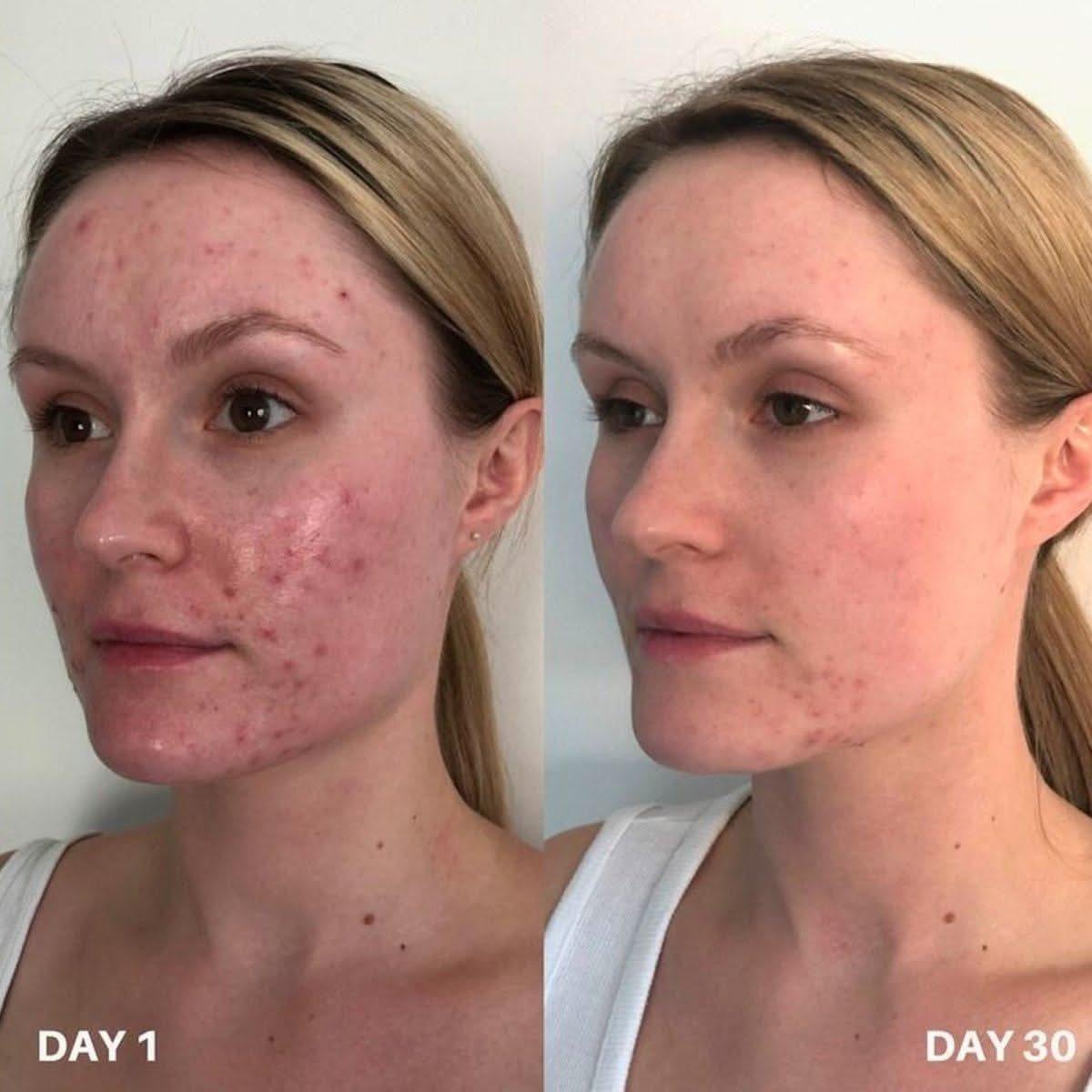 Clinisoothe+ | Skin Purifier | 100ml - Glam Global UKClinisoothe+