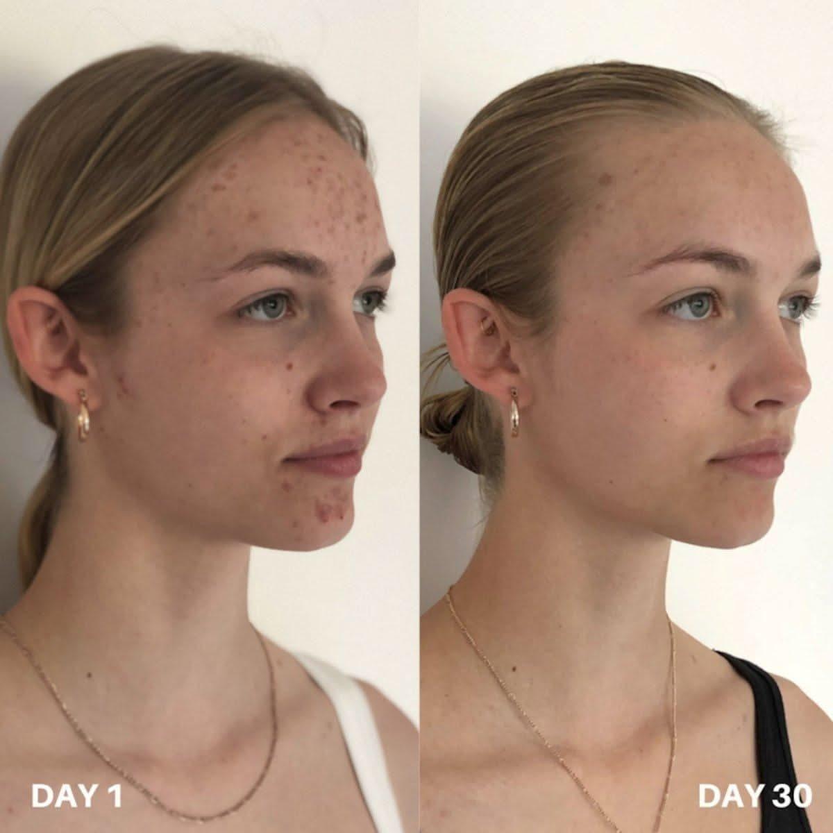 Clinisoothe+ | Skin Purifier | 100ml - Glam Global UKClinisoothe+