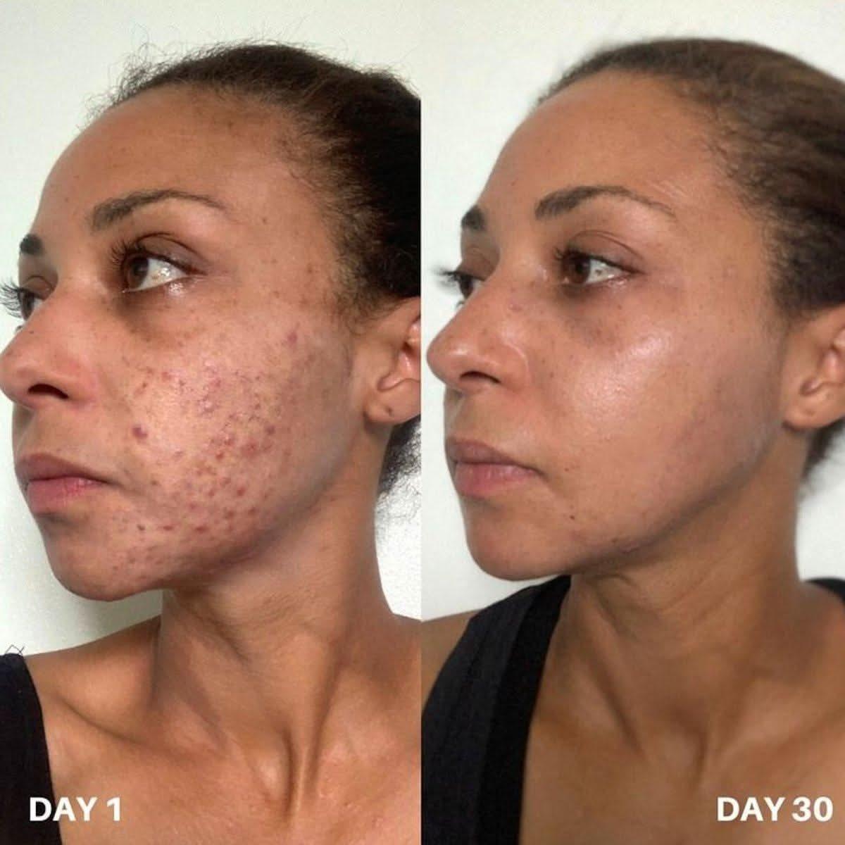 Clinisoothe+ | Skin Purifier | 250ml - Glam Global UKClinisoothe+