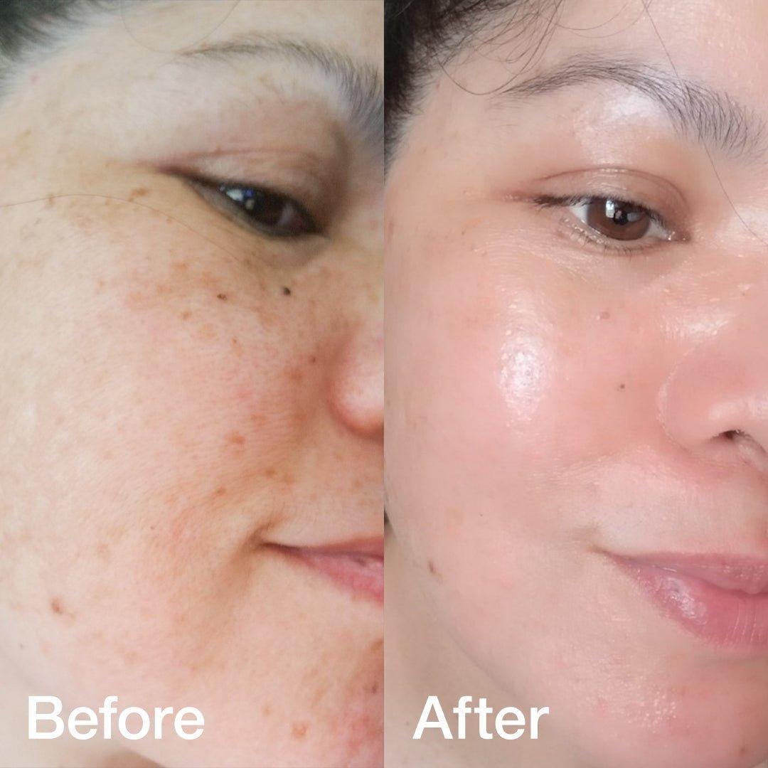 Medicube Collagen Booster Set - Glam Global UKMedicube