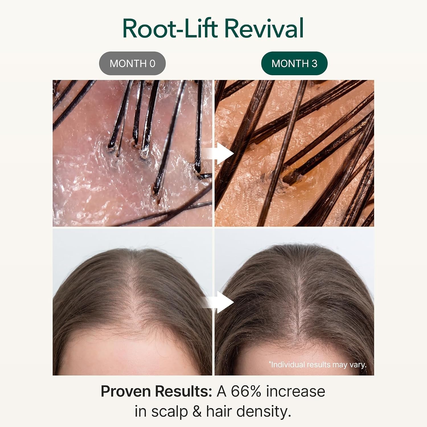 Vivelab Micro Foam Scalp Treatment - Hair Growth Serum for Thicker Hair, Premium Scalp Care with Biotin, Rosemary Oil & Caffeine, Clinically Tested Thinning Hair Care, Vegan