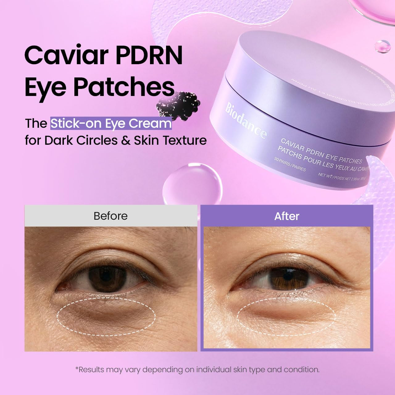 BIODANCE Caviar PDRN Eye Patches – 60 Count | Nourishing Under-Eye Masks | Dark Circles, Puffiness & Tired Eyes | Korean Skincare