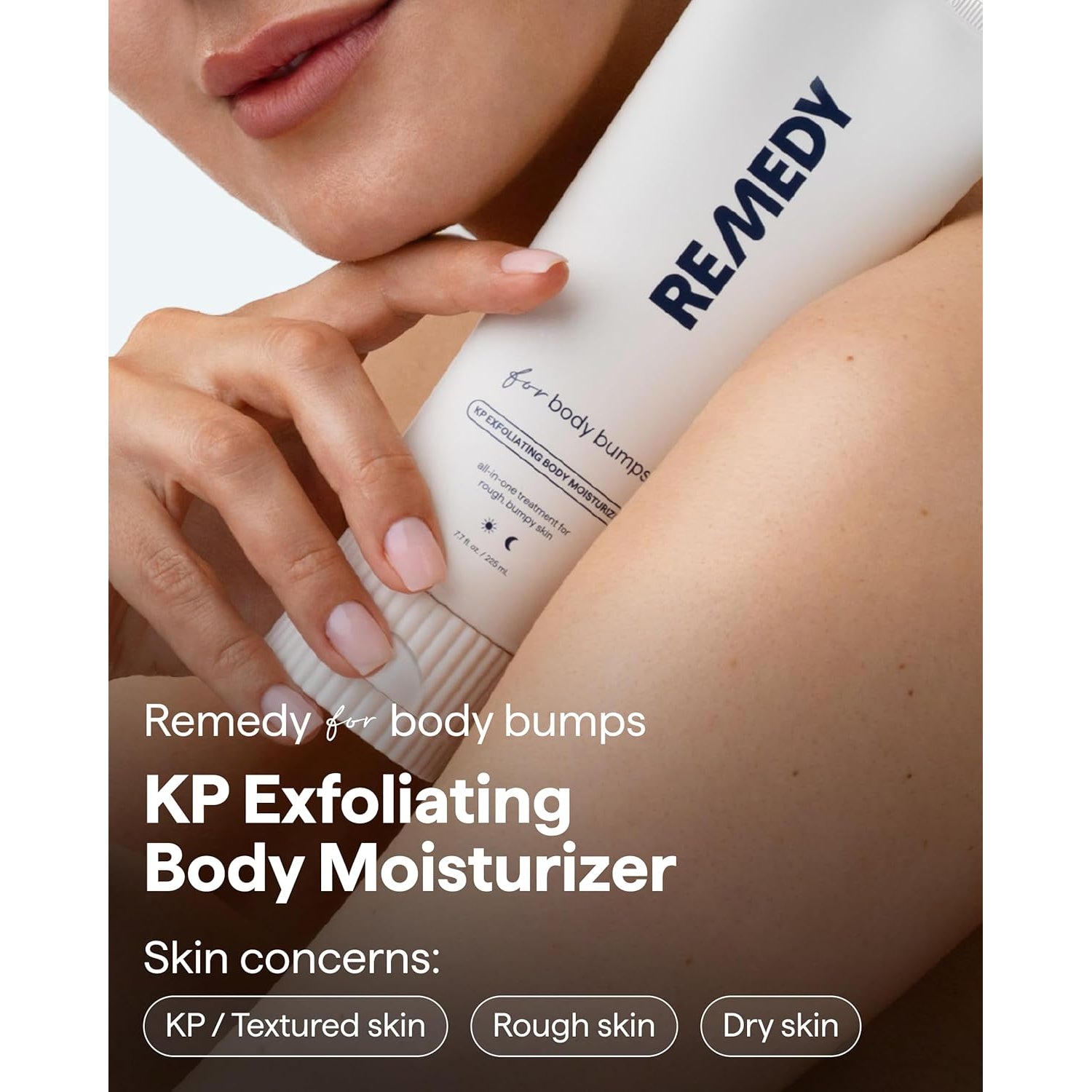 Remedy for Body Bumps KP Body Moisturizer - 225ml