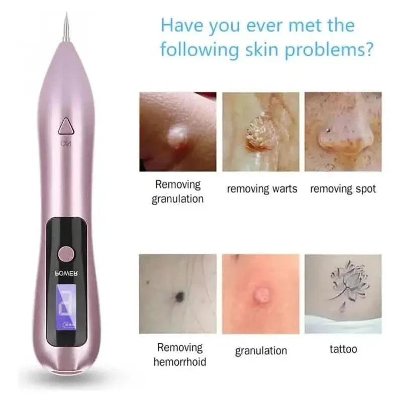 Dark Spot & Tattoo Remover Pen – Advanced Skin Spot Eraser with Precision Control - Glam Global UKGlam Global UK