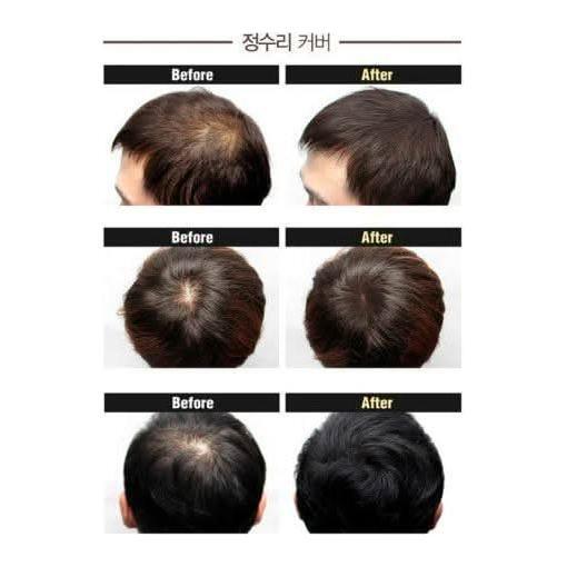 DASHU Anti - Hair Loss Hair Cushion | Instant Scalp & Hair Care (Natural Brown) 16g - Glam Global UKDASHU