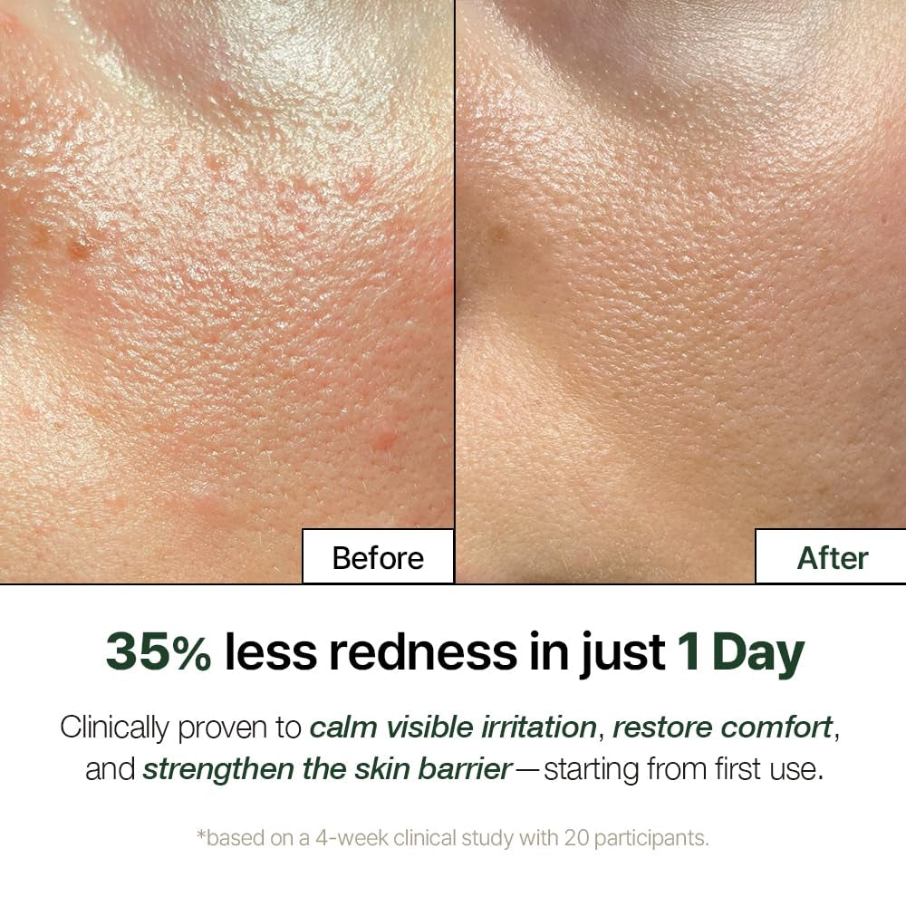 NATURAL DERMA PROJECT NDP Cica Cream - Gel Face Moisturizer for Sunburn Relief, Lightweight Korean Moisturizer for Sensitive Skin, Centella Asiatica, Hydrating, Calming, Soothing (1.7 Fl Oz / 50Ml)