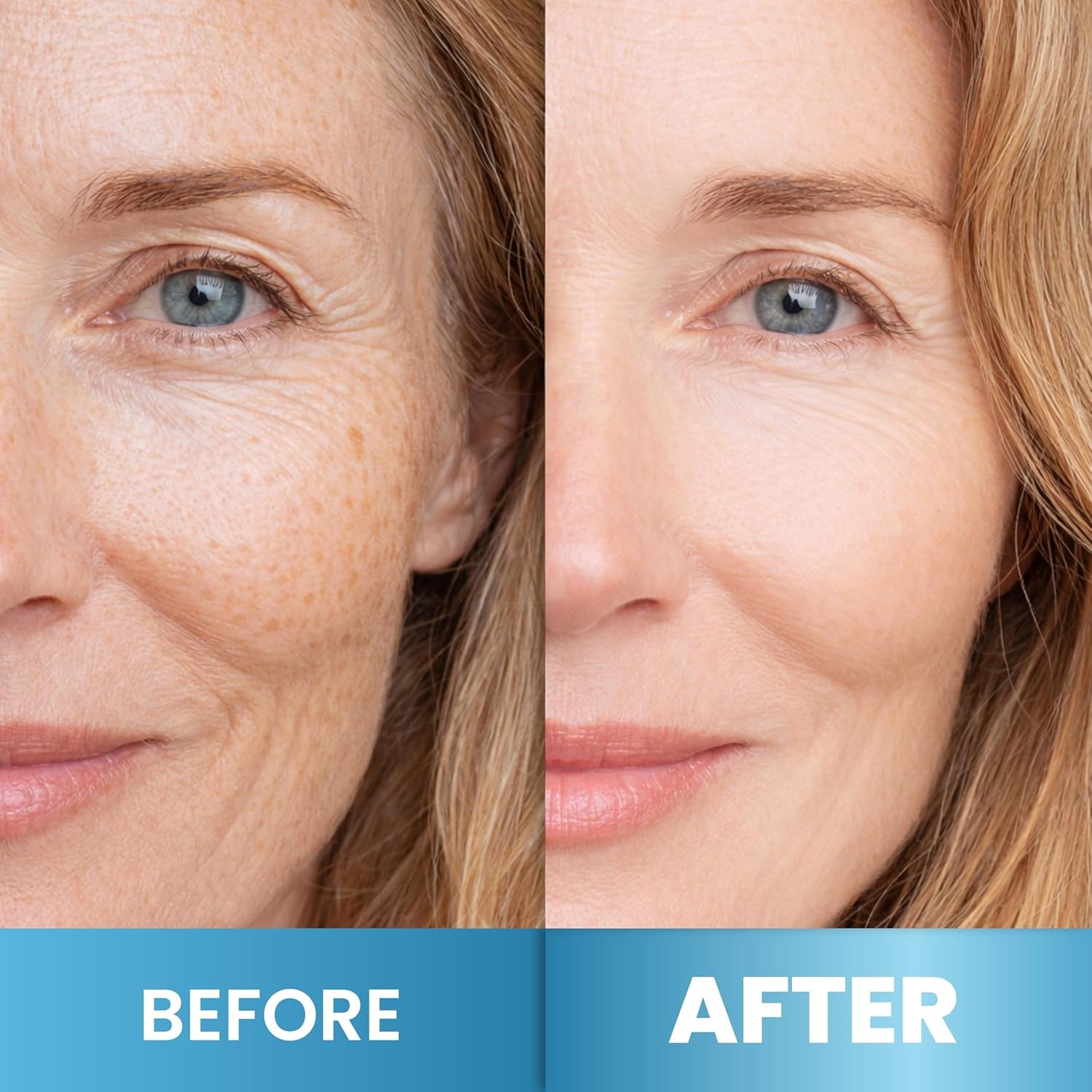 Retinol Cream for Face - Anti-Aging Moisturizer Wrinkle Cream with Collagen & Hyaluronic Acid - Face & Neck Moisturizer for Firming, Hydration & Smooth Skin - Day & Night Skin Care for Women & Men