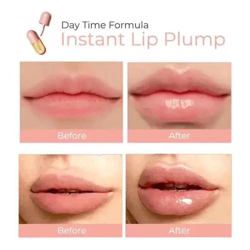 DEROL™ Lip Plumper Kit | Day & Night Lip Treatment - Vegan & Cruelty - Free - Glam Global UKDEROL