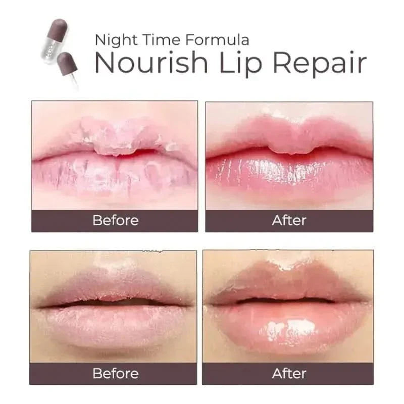 DEROL™ Lip Plumper Kit | Day & Night Lip Treatment - Vegan & Cruelty - Free - Glam Global UKDEROL