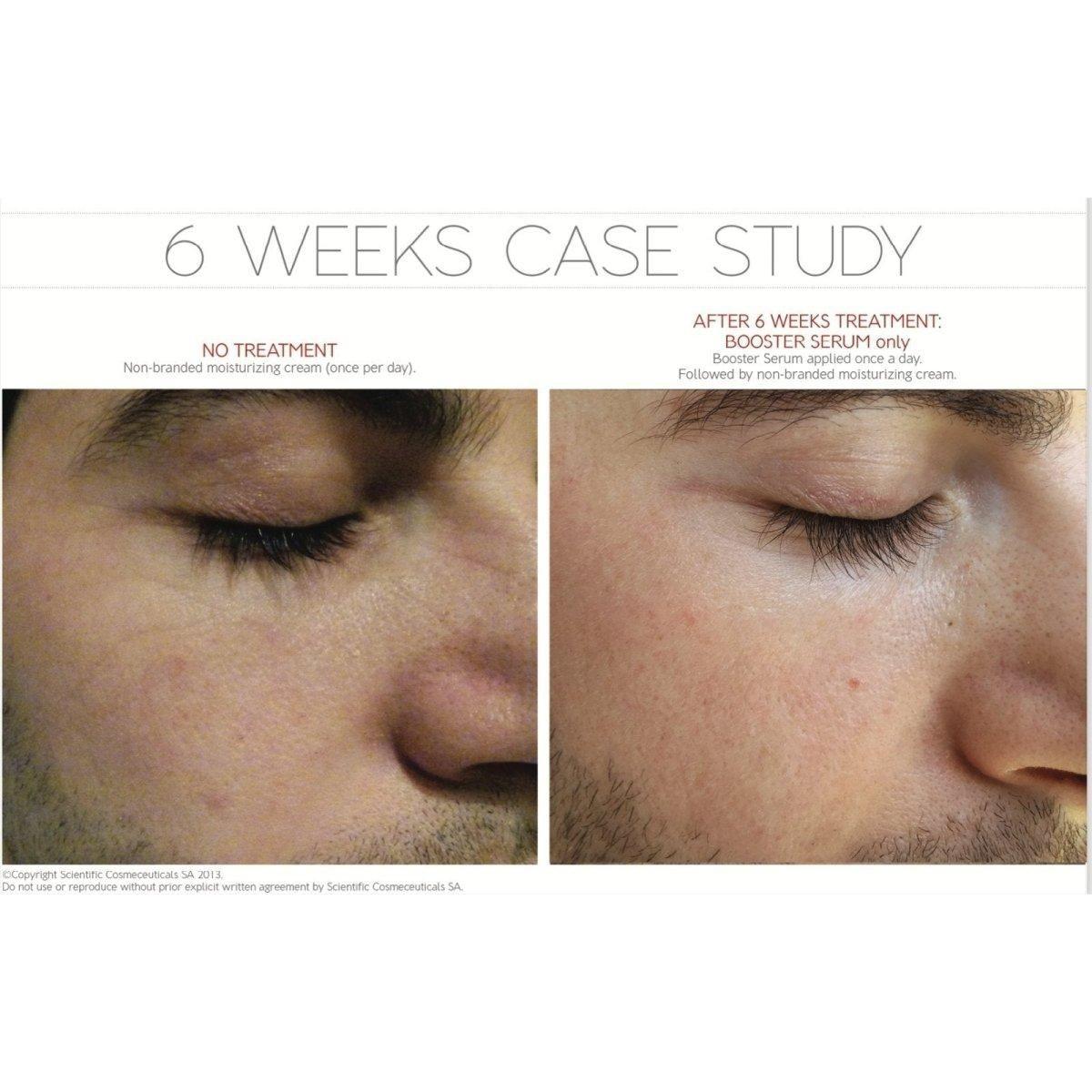 Dr LEVY Switzerland | Booster Serum - Glam Global UKDr Levy Switzerland