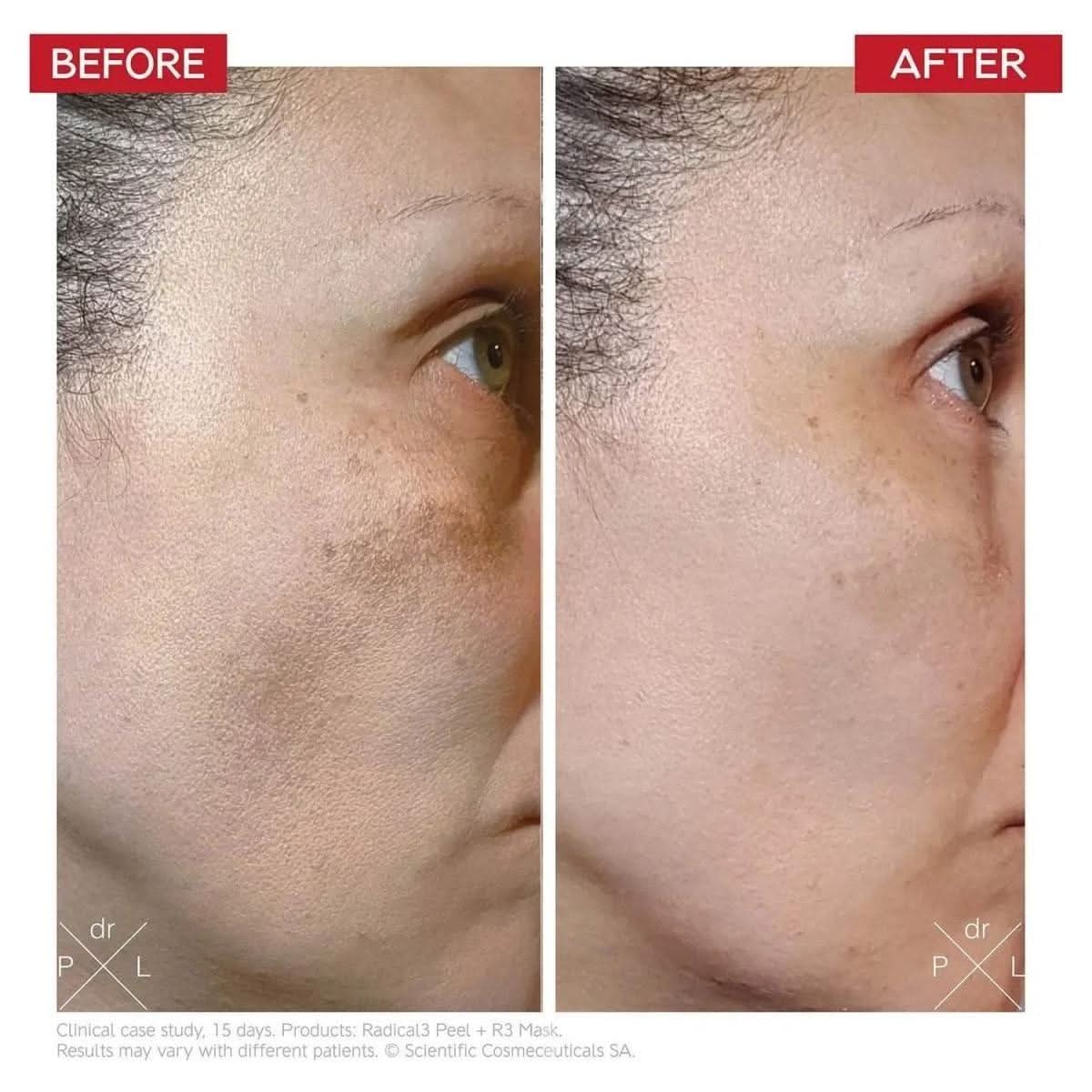 Dr LEVY Switzerland | Radical3 Reboot Pro Peel - Glam Global UKDr Levy Switzerland
