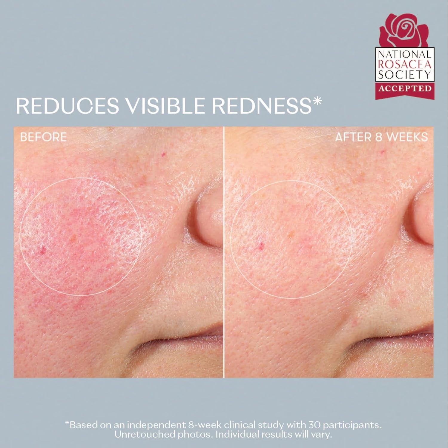 RescueMD DNA Repair Complex Pro Serum – 120ml | Scar Treatment & Post-Procedure Skin Recovery | Skin Damage Repair Solution