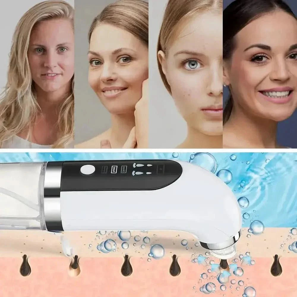 Electric Small Bubble Blackhead Remover – Reveal Clear, Radiant Skin - Glam Global UKGlam Global UK