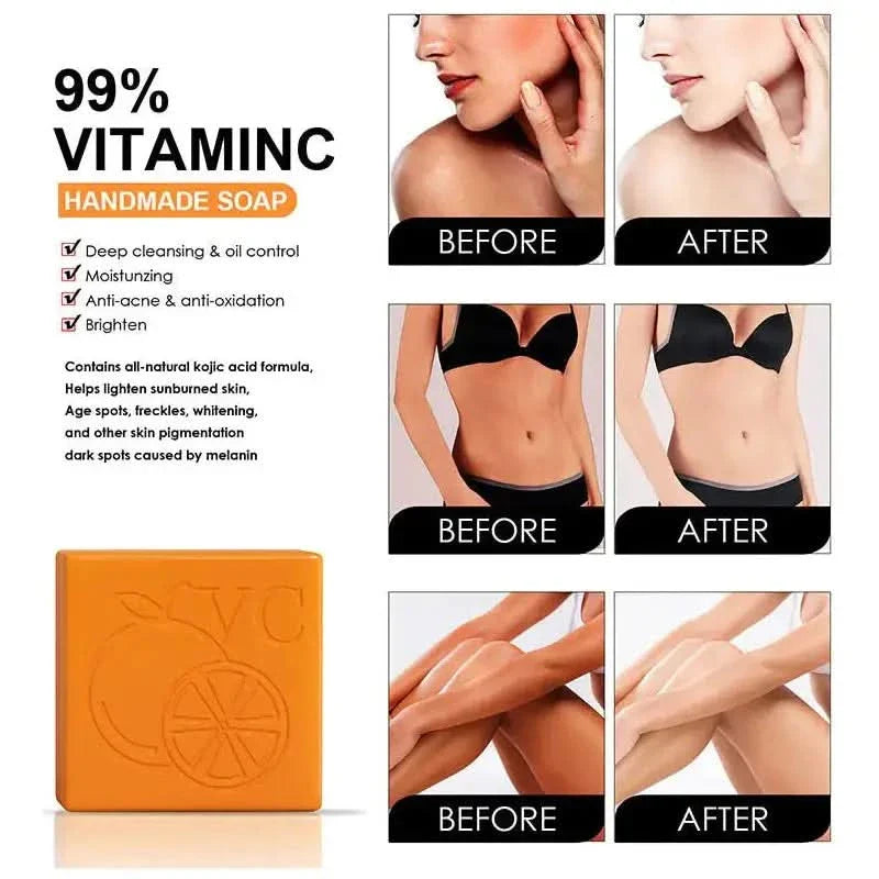 Elements™ Vitamin C Whitening Soap - 100g - Glam Global UKElements