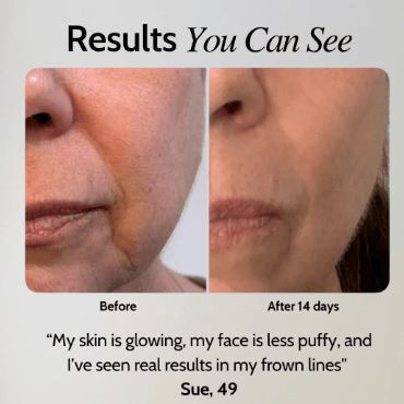 EMS Facial Toner Gel & Device – Non - Invasive Skin Toning and Rejuvenation System - Glam Global UKGlam Global UK