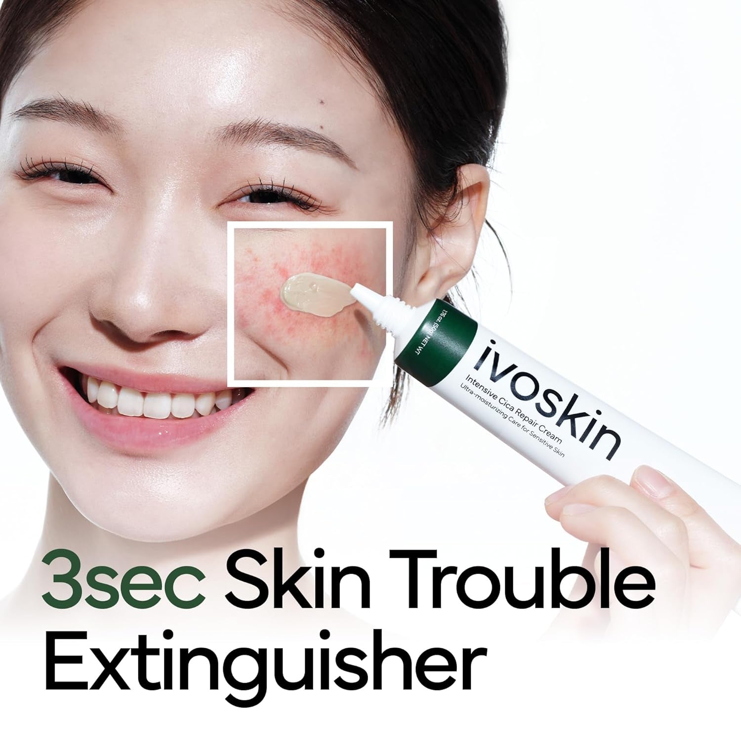 IVOSKIN Intensive Cica Repair Cream – 50g | Soothing Barrier Cream for Redness, Sensitivity & Acne Recovery