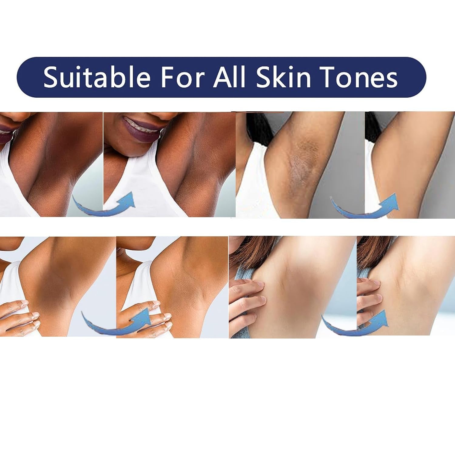 GUKEI Skin Whitening Cream Bleaching Cream for Body Intimate Area, Private Parts, Underarm, Knees, Elbows, Inner Thigh, Bikini Areas, Bikini Line, Skin Lightening Dark Spot Remover for Intimate Areas 60ML