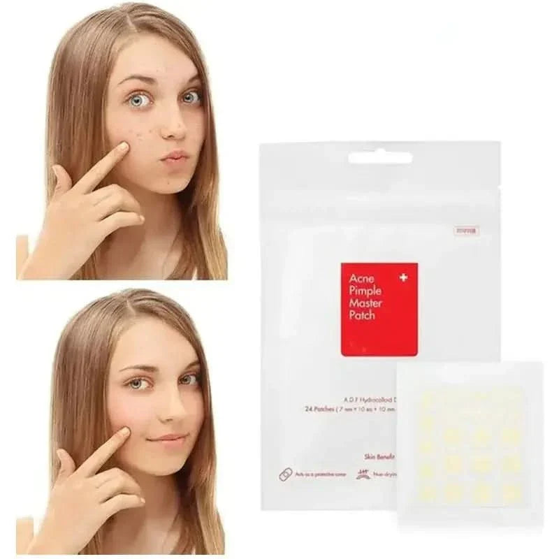 Face Acne Pimple Spot Scar Care Treatment Stickers - Glam Global UKGlam Global UK