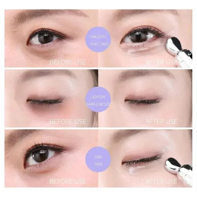 Hexapeptide Eye Cream - Reduces Eye Bags and Puffiness: - 15ml - Glam Global UKGlam Global UK