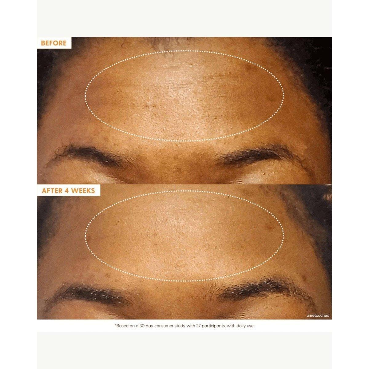 Kinship Brightwave 10% Vitamin C + Peptide Brightening Serum - 30ml - Glam Global UKKinship