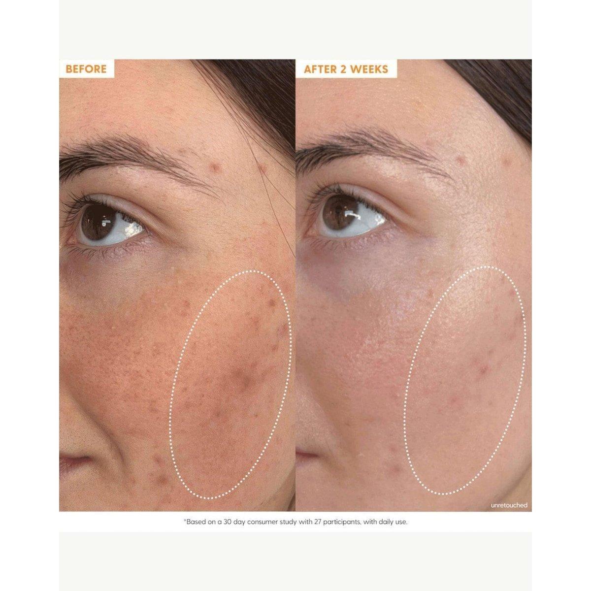 Kinship Brightwave 10% Vitamin C + Peptide Brightening Serum - 30ml - Glam Global UKKinship