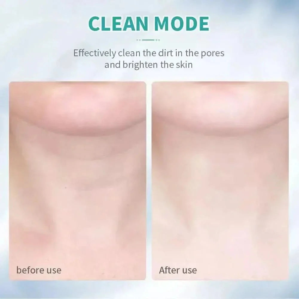 LED Light Therapy & Heat Treatment Anti Wrinkle Face & Neck Massager - Glam Global UKGlam Global UK