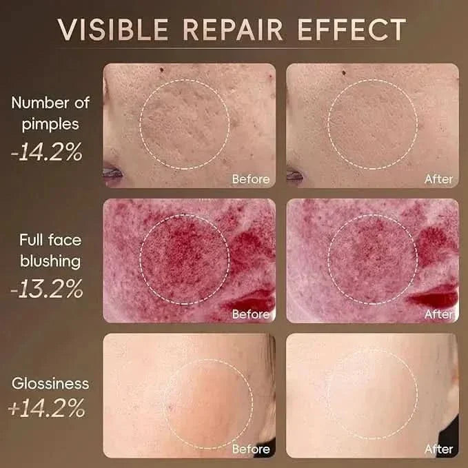 Light Therapy Face Mask - Glam Global UKGlam Global UK