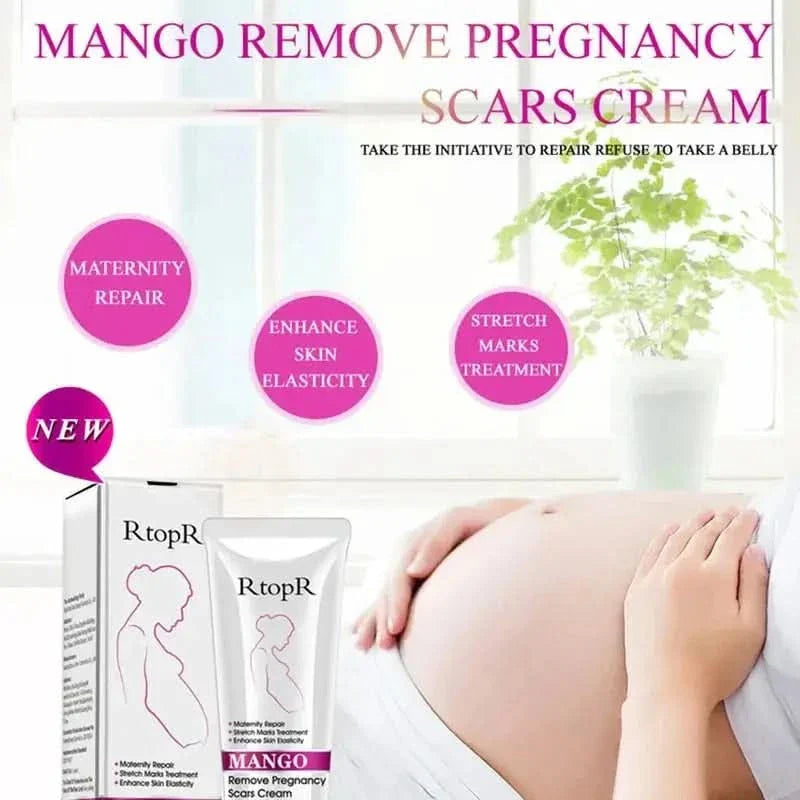 RtopR Mango Stretch Mark Cream For Pregnancy Repair - 40g - Glam Global UKRtopR
