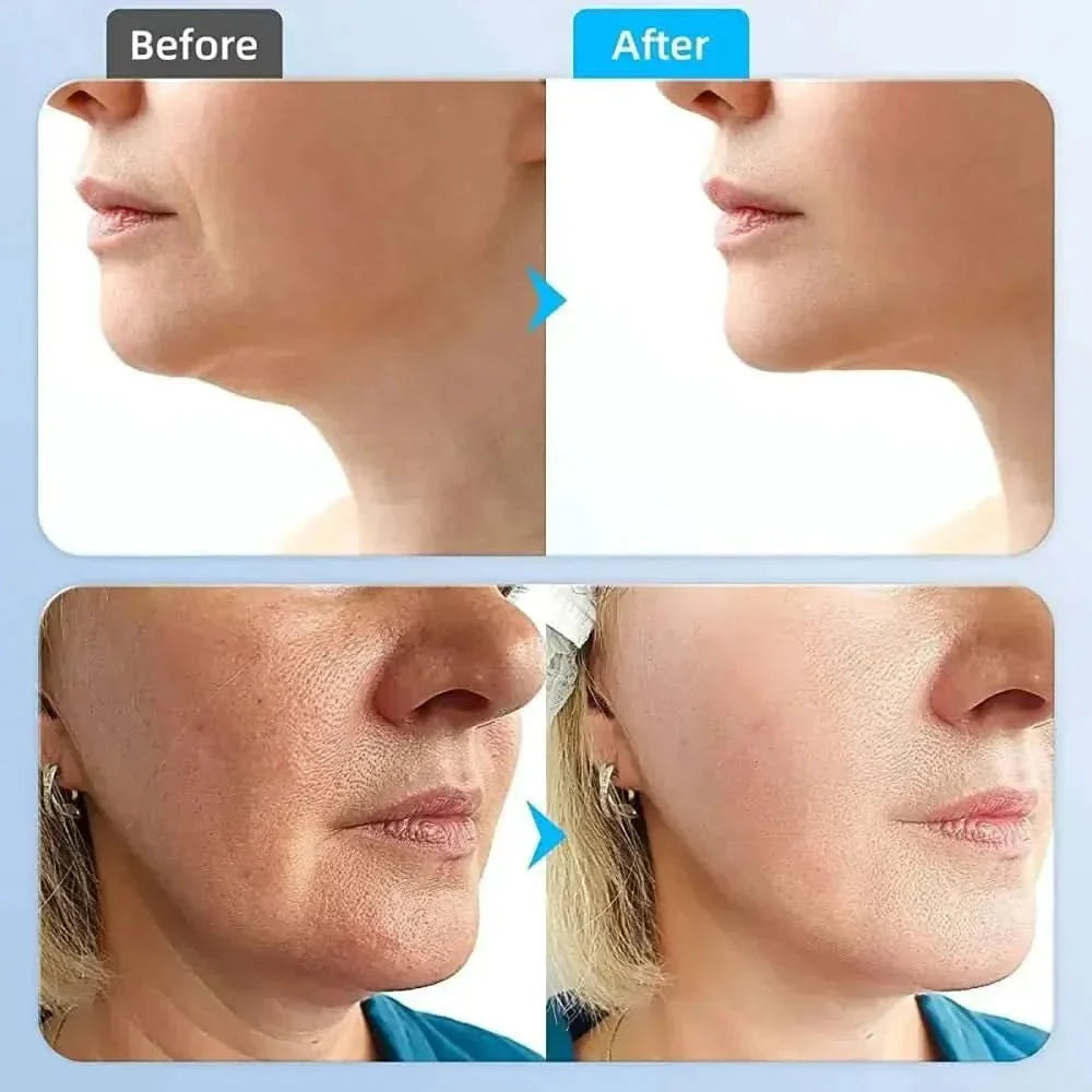 Microcurrent Face Massager Anti Wrinkle Skin - Glam Global UKGlam Global UK